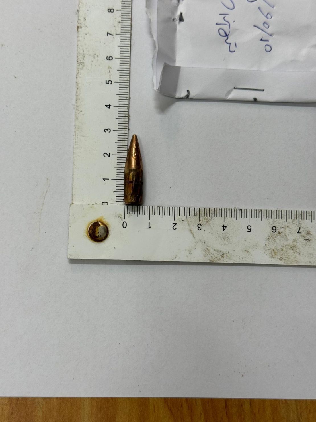 A bullet pulled by doctors from a patient at Nasser Hospital in Sunday